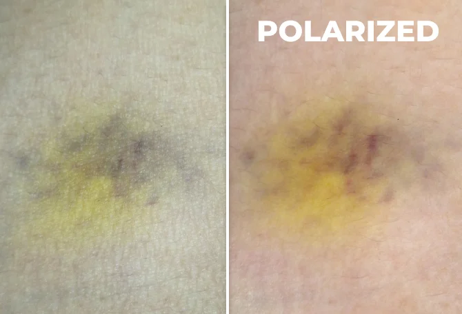 Polarize-Superspektral-Goruntuleme